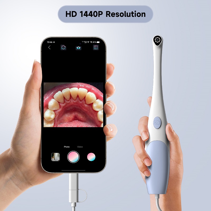 Kamera Endoskop Oral 1440P Fot - Photography Lighting Continuous ulasan dan harga