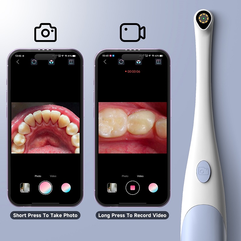 Kamera Endoskop Oral 1440P Fot - Photography Lighting Continuous ulasan dan harga